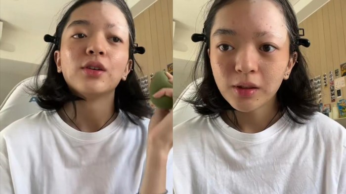 Fakta-fakta Wanita Jakbar Idap Vitiligo usai Bleaching