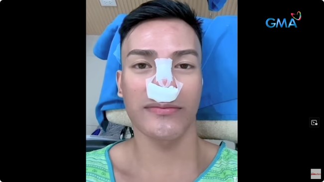 Dilansir Koreaboo, beberapa tahun lalu pria itu pernah ditolak oleh seorang wanita cantik yang merupakan tipe idealnya. Ketika itu, hatinya sangat hancur hingga memutuskan untuk mengubah penampilan sebagai bentuk balas dendam. Foto: Instagram Juls Rael