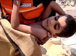 Anak yang 9 Hari Terjebak Reruntuhan di Gaza Berhasil Diselamatkan