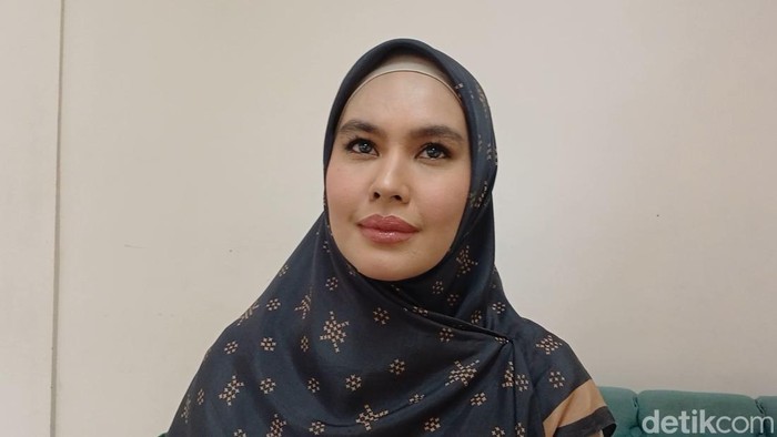 Kondisi wajah Kartika Putri membaik