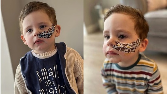 Kisah Anak Alami GTM Terparah, Tolak Makan Apapun Selama Lebih dari Setahun