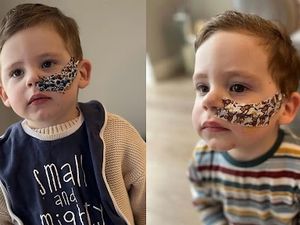 Kisah Anak Alami GTM Terparah, Tolak Makan Apapun Selama Lebih dari Setahun