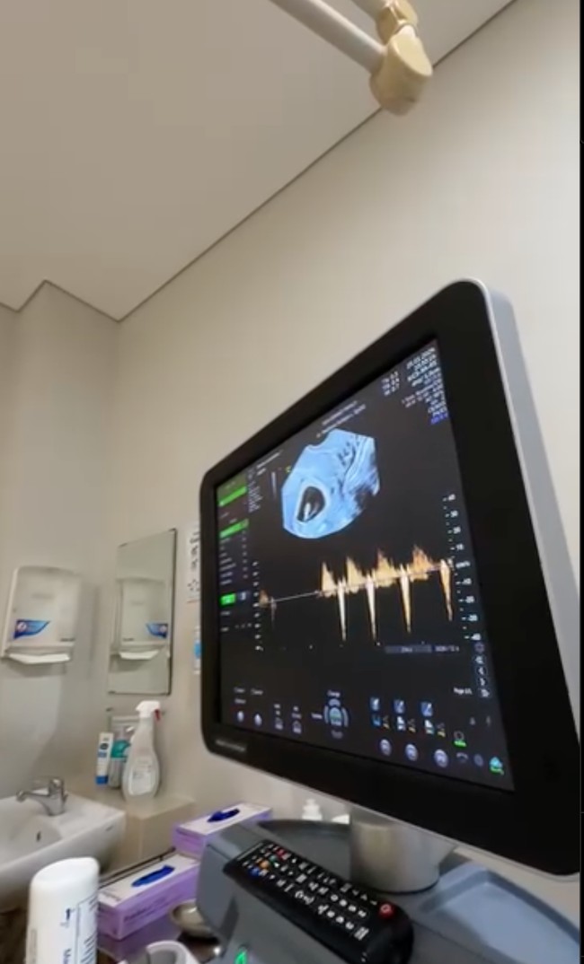 Tak hanya memamerkan test pack positif, Shanju dan Jonathan juga memperlihatkan momen USG anak pertama mereka. Keduanya begitu bahagia bisa mendengar detak jantung sang jabang bayi. Foto: Instagram/@shanju