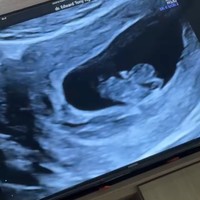 Saat di USG terlihat sang jabang bayi aktif bergerak. Tak sedikit netizen yang mendoakan agar Shanju dan bayi dalam kandungannya selalu sehat hingga proses persalinan nanti. Foto: Instagram/@shanju