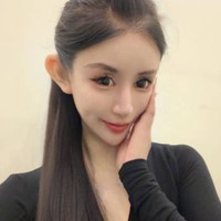 Hingga kini Zhou disebut sudah menjalani lebih dari 100 tindakan untuk mencapai penampilan impian. Dokter pun mewanti-wanti Zhou Chuna agar tidak lagi operasi. Sebelumnya ia bahkan sudah 10 kali melakukan tindakan pada mata tapi masih berniat memperbaiki lagi. Padahal orang-orang wajahnya sudah sangat berubah bahkan tidak mengenali. Foto: Dok. Weibo