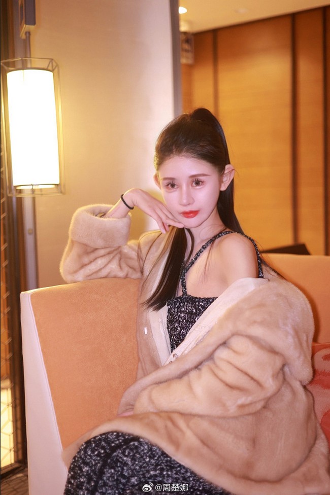 Sejak saat itu, Zhou bertekad untuk mengubah penampilannya. Dengan izin dari ibunya, Zhou mulai terobsesi setelah menjalani operasi pertamanya pada usia 13 tahun. Ia bahkan sempat berhenti sekolah. Foto: Dok. Weibo