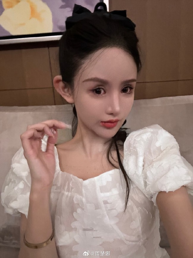 Zhou sudah tidak bisa lagi melakukan operasi, wajahnya akan rusak. Operasi selanjutnya akan menyebabkan banyak efek samping, termasuk kedutan otot, kegagalan saraf wajah, dan kerusakan otak akibat penggunaan obat bius yang berlebihan, kata dokter Lin Yonggang dilansir The Post. Foto: Dok. Weibo