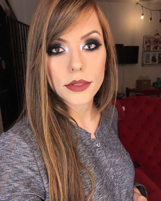 Meski membuat wajahnya unik, sayangnya kondisi tersebut sebenarnya mengganggu kesehatan mata Anelize. Ia disebut hanya punya 30% penglihatan di mata kanan dan punya kondisi miopi dan rabun jauh.  Foto: Instagram Anelize Kloster