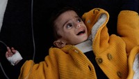 Bocah Palestina Ahmed Qannan, yang menderita kekurangan gizi akibat bencana kelaparan di Gaza, Palestina.