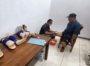 Puluhan Difabel Banyumas Terima Bantuan Kaki-Tangan Palsu dari Kemensos