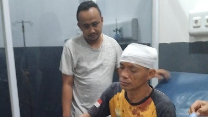 Kondisi korban yang mengalami luka robek akibat dipukul Zainal pakai helm.