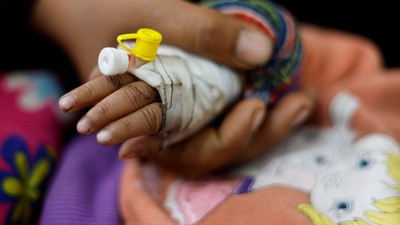 Sedihnya Melihat Anak-anak Gaza Alami Malnutrisi