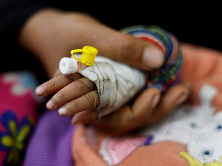 Sedihnya Melihat Anak-anak Gaza Alami Malnutrisi