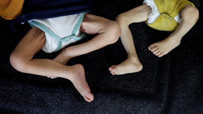 Nasib Pilu Anak-anak di Gaza: Tewas karena Bom atau Mati karena Kelaparan