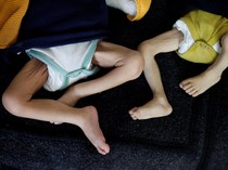 Israel Bikin Anak-anak di Gaza Malnutrisi Bahkan Mencapai Level Ekstrem