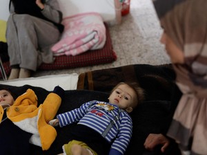 Malnutrisi Parah, Anak-anak Gaza Bahkan Tak Punya Tenaga untuk Menangis!