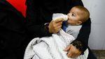 Sedihnya Melihat Anak-anak Gaza Alami Malnutrisi