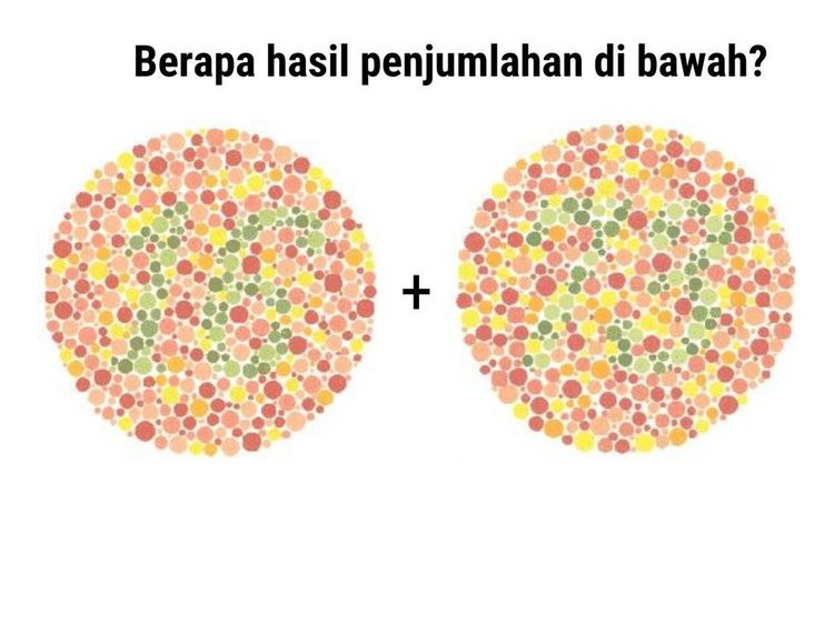 Tes Buta Warna, Anak IPA Harusnya Benar Semua
