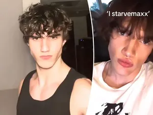 Viral Stravemaxxing yang Berbahaya: Paksa Remaja Tak Makan Berhari-hari