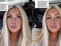 Dialami Wanita 22 Tahun, Keseringan Botox Bisa Bikin Wajah Lebih Tua?