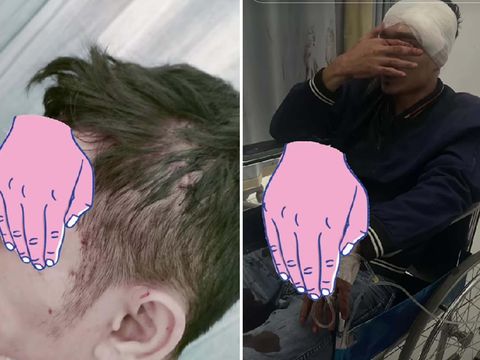 Makeup artist (MUA) ini mengungkapkan ketika menagih pembayaran usai menggelar pesta pernikahan, keluarga pengantin pria malah menganiaya hingga korban mengalami 27 jahitan. Kasus tersebut langsung viral di media sosial