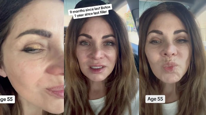 Update wanita yang viral setelah berhenti botox selama 20 tahun