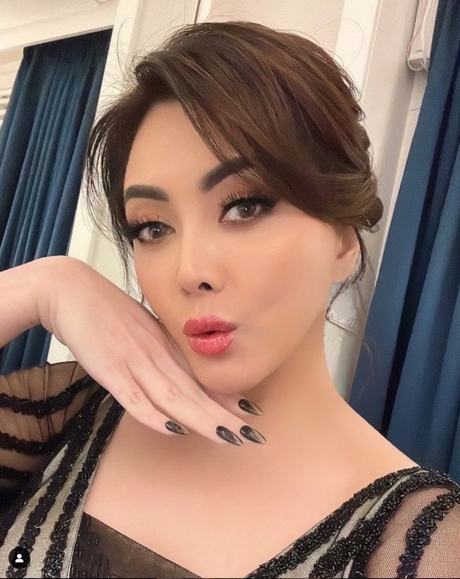 Operasi plastik yang dipilih Dhena sendiri tidak mengubah bentuk wajahnya secara drastis. Ia lebih fokus di prosedur mini lift dan fat graft untuk memberikan efek peremajaan. Foto: Instagram/@dhenaaldhaliadevanka