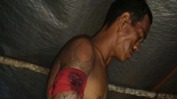 Efendi (32) pencari sagu yang diterkam harimau di Siak, Riau. (Istimewa)