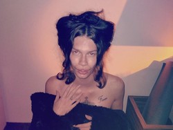 Wanita Ini Ingin Jadi Kucing, Transformasi Ekstrem Lewat Operasi Plastik