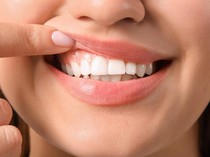 Hari Kesehatan Gigi dan Mulut 12 September: Sejarah dan Cara Merayakan