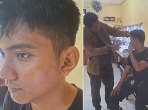 Kondisi Polisi di Makassar yang Dikeroyok 4 Pengantar Jenazah Arogan