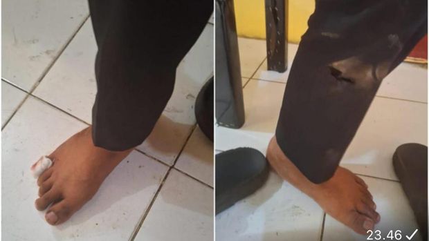 Polisi di Makassar dikeroyok pengantar jenazah. Dokumen Istimewa