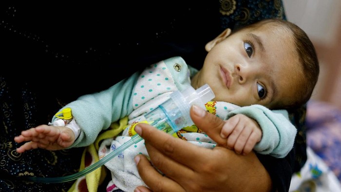 Palestinian woman Wafaa Tabasi holds her twin malnourished daughter Sameera, At al-Awda health centre in Rafah in the southern Gaza Strip, March 12, 2024. REUTERS/Mohammed Salem     TPX IMAGES OF THE DAY