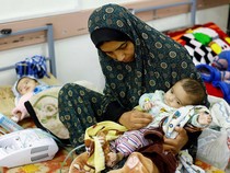 Duka Wafaa dan Putri Kembarnya yang Kurang Gizi Imbas Bencana Kelaparan di Gaza