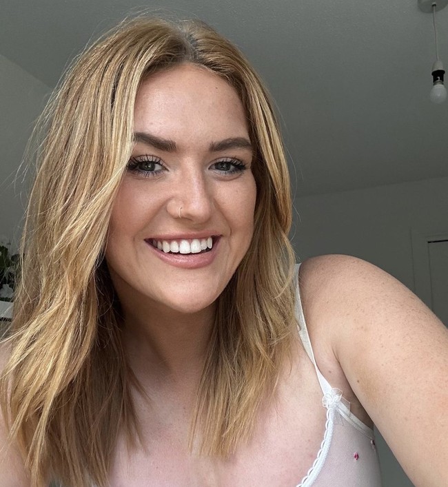 Pada usia 16 tahun, Annie mengetahui bahwa ia memiliki kondisi langka tersebut. Sempat terpuruk dengan kondisinya, namun justru masalah medisnya itu yang kini menjadi kekuatannya. Foto: Dok. Intagram @twopssyprincess