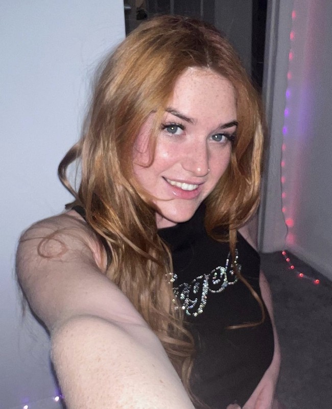 Annie Charlotte lahir dengan diagnosa uterus didelphys, sebuah kondisi di mana ia lahir dengan dua alat kelamin dengan dua rahim dan dua leher rahim. Foto: Dok. Intagram @twopssyprincess