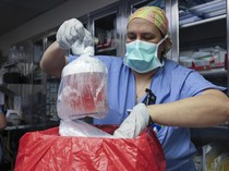 Potret Pria Pertama di Dunia yang Jalani Operasi Transplantasi Ginjal Babi