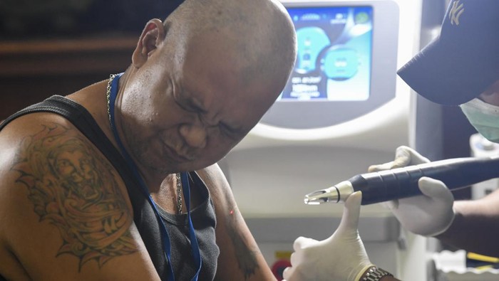 Ramadan Berkah, Ratusan Orang Ikut Hapus Tato Gratis di Jaktim Petugas medis dari Islam Medical Service (IMS) Center menghapus tato peserta dengan menggunakan laser di Kantor Wali Kota Jakarta Timur, Cakung, Jakarta, Rabu (20/3/2024). Sebanyak 167 peserta ikut dalam program road show hapus tato yang digelar BAZNAS (BAZIS) DKI Jakarta yang bertujuan memberikan kesempatan kepada warga yang ingin hijrah menjadi manusia yang lebih baik. ANTARA FOTO/M Risyal Hidayat/nym.