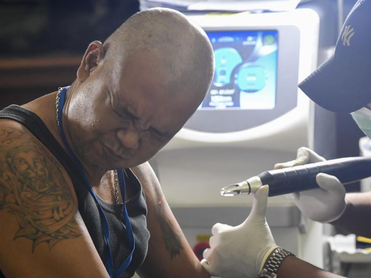 Raih Berkah Ramadan, Ratusan Orang Ikut Hapus Tato Gratis