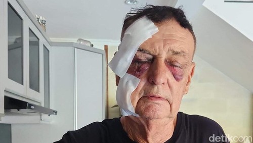 Warga Australia, Graham Murray Leggett, yang diduga mengalami penganiayaan oleh rekan bisnis senegaranya di Bali.