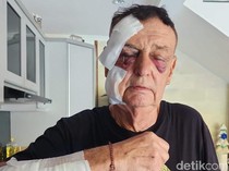 Jadi Korban Penganiayaan, Bule Australia Malah Akan Dideportasi dari Bali