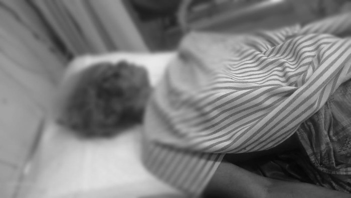 Wagirah dengan kondisi luka parah di muka dan badan saat diserang beruang