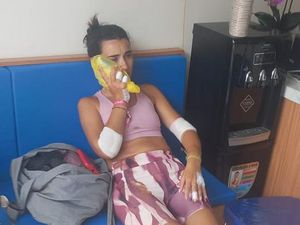 Bule Spanyol Babak Belur, Kalungnya Dijambret saat Naik Motor di Bali