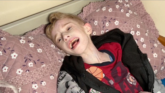 Anak-anak Gaza menderita 'kekurangan gizi parah dengan komplikasi', kata WHO, Kamis (21/3)