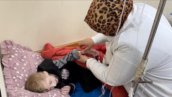 Potret Pilu Anak-anak di Gaza Menderita Kekurangan Gizi Parah