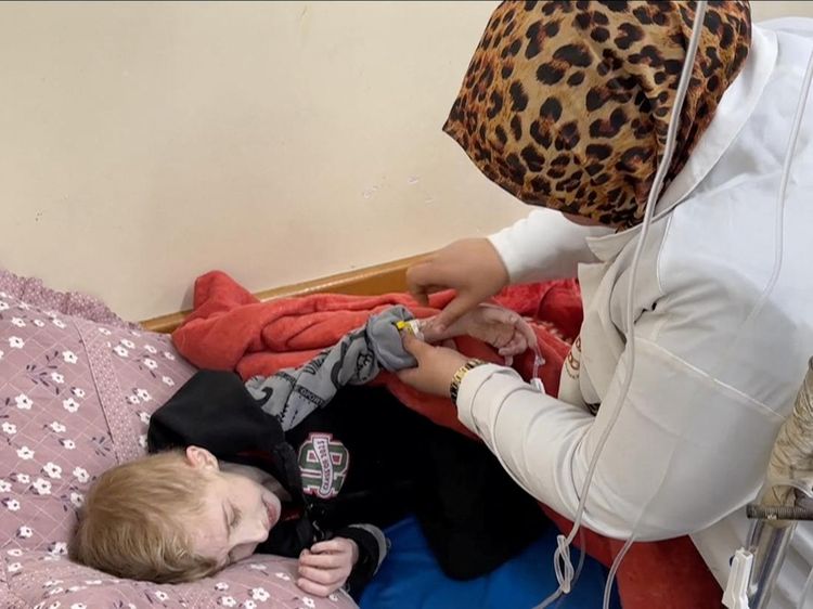 Potret Pilu Anak-anak di Gaza Menderita Kekurangan Gizi Parah