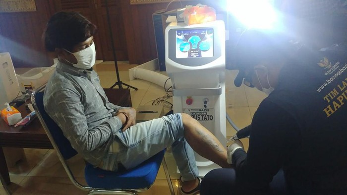 Layanan Hapus Tato Gratis dari Baznas