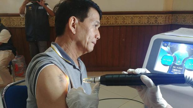 Salah satu peserta hapus tato gratis