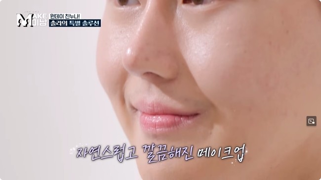 Pria 28 tahun tersebut pun tak ragu memamerkan wajah barunya kepada netizen. Setelah operasi, tidak bisa dipungkiri bahwa auranya terlihat berubah.  Foto: Dok. YouTube Hellotv