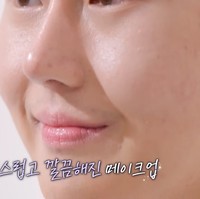 Pria 28 tahun tersebut pun tak ragu memamerkan wajah barunya kepada netizen. Setelah operasi, tidak bisa dipungkiri bahwa auranya terlihat berubah.  Foto: Dok. YouTube Hellotv